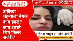 Urfi Javed Lip Fillers Dissolved | उर्फीचा चेहरा सुजला, ओळखणंही कठीण! उर्फीच्या चेहऱ्याला नेमकं काय झालं?