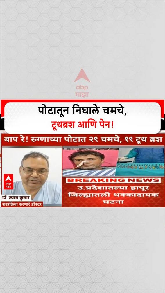 Man Swallowed 50 Objects | पोटातून 29 चमचे, 19 Toothbrush, 2 Pen काढले!