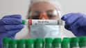 Australia Confirms First Case Of H5 Bird Flu, PM Albanese Says Detection Concerning