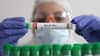 Australia Confirms First Case Of H5 Bird Flu, PM Albanese Says Detection Concerning