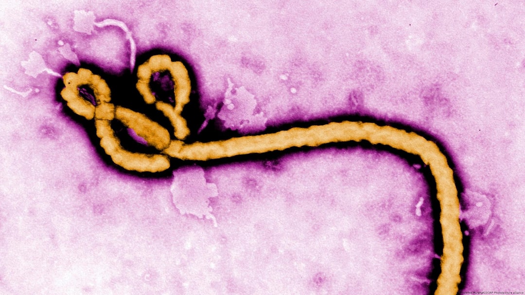 France Confirms First Ebola Case Linked To DR Congo Outbreak france first ebola case democratic republic congo outbreak humanitarian aid doctor paris France Confirms First Ebola Case Linked To DR Congo Outbreak