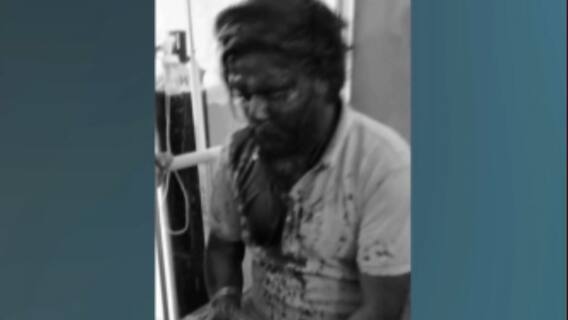 Telangana: Violence broke out between two communities, 6 injured