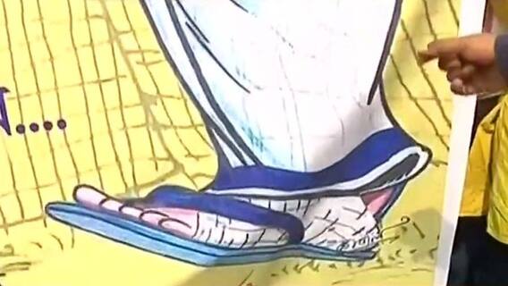 'ভাঙা পায়েই খেলা হবে', ব্যানার হাতে হাসপাতালে TMC সমর্থকরা