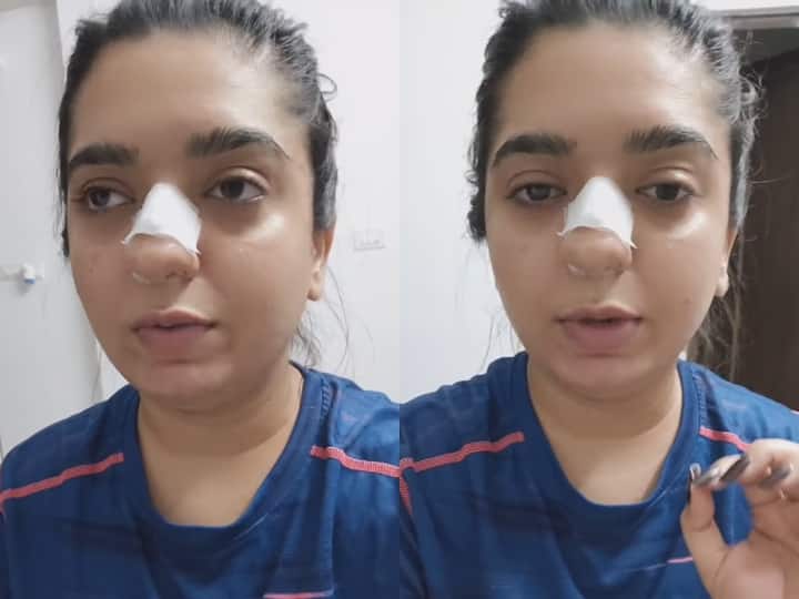 Zomato Delivery Boy Assaults Beauty Influencer; Arrested By Bengaluru Police Bengaluru Police Arrests Zomato Delivery Boy Who Assaulted Beauty Influencer