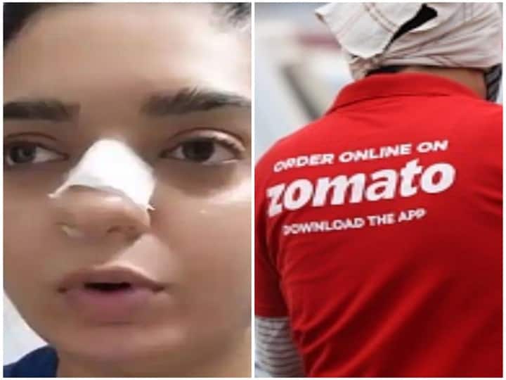 Zomato delivery man, accused by Bengaluru woman of an assault, filed an FIR against her at the same police station where she registered case against him.