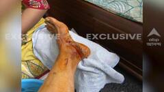 West Bengal Election 2021: ‘একটা পায়ের বদলা ....’, আঘাত নিয়ে ফের বিজেপিকে আক্রমণ Mamata-র