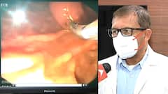 शरद पवारांवर दुर्बिणीद्वारे यशस्वी शस्त्रक्रिया, पवारांवर शस्त्रक्रिया करणारे डॉ. मायदेव 'माझा' वर