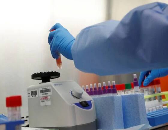 What tests are done for corona virus? Why  R T PCR test is more reliable? Coronavirus: કોરોના વાયરસ માટે કયા કયા ટેસ્ટ કરવામાં આવે છે? શા માટે R T PCR ટેસ્ટ વધુ વિશ્વનિય છે?