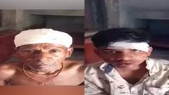 West Bengal Election 2021: ইলামবাজারে বিজেপি কর্মীদের ওপর 'হামলা', আহত ৫