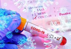 அதிகரிக்கும் கொரோனா பரவல்.. சென்னையில் இன்று முதல் தொடங்கும் காய்ச்சல் முகாம்கள்..