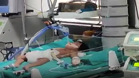 બાળકોમાં આ દસમાંથી એક પણ લક્ષણો જોવા મળે તો તરત કરાવો કોવિડ-19નો ટેસ્ટ, હોઇ શકે છે કોરોના