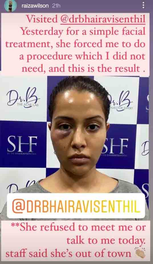 Bigg Boss Fame Raiza Wilson’s Facial Treatment Goes Wrong; Says She Was ‘Forced’ To Undergo Dermatological Procedure