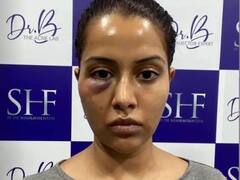 எனக்கு விருப்பமில்லாத சிகிச்சையை அளித்தார்.. தோல் மருத்துவர் மீது பிக்பாஸ் ரைசா குற்றச்சாட்டு..