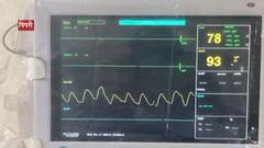 Special Report : HRCT मुळे वाचले अनेकांचे प्राण, कोरोना रिपोर्ट निगेटिव्ह तरीही फुफ्फुसांना संसर्ग