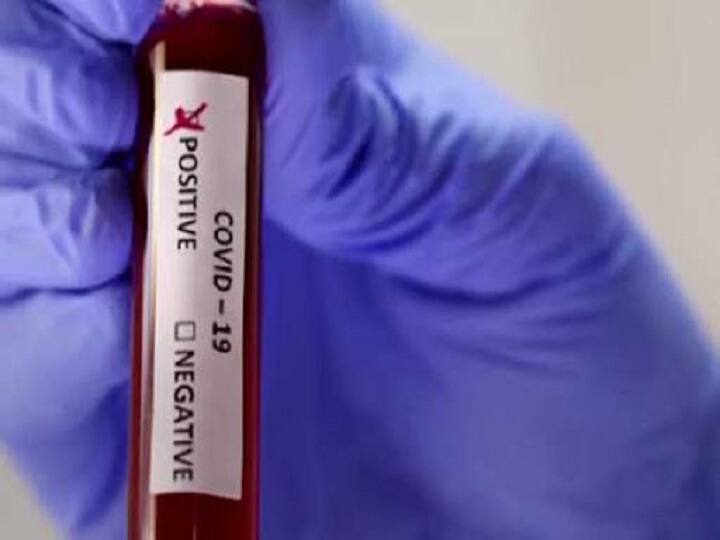 Kalyan 30 inmates from Kalyan Adharwadi Jail were tested positive for COVID19 कल्याणच्या आधारवाडी कारागृहात कोरोनाचा शिरकाव, 30 कैद्यांना कोरोनाची लागण