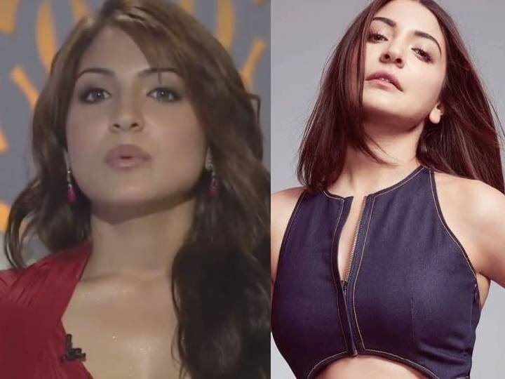 फिल्म बॉम्बे वेलवेट की रिलीज के समय अनुष्का शर्मा के लिप्स की खबू चर्चा हुई. 2014 में अनुष्का जब करन जौहर के चैट शो 'कॉफी विद करण' में पहुंचीं उसके बाद इसे लेकर कई तरह की खबरें बनीं. इसके बाद अनुष्का शर्मा ने कहा था कि उन्होंने फिल्म के लिए टेम्प्ररी लिप इनहैंसिंग टूल और मेकअप टेक्नीक का इस्तेमाल किया था. हालांकि बाद में अनुष्का शर्मा ने Vogue के दिए एक इंटरव्यू में ये स्वीकार किया कि उन्होंने  'lip job' कराया है. अनुष्का ने वोग से कहा था, ''मैंने कुछ नहीं छिपाया है. जब मैंने अपने लिप जॉब के बारे में बात की तो लोगों ने मुझे साहसी बताया. लेकिन मैंने जो भी किया अपनी फिल्म Bombay Velvet के कैरेक्टर के लिए किया था.''