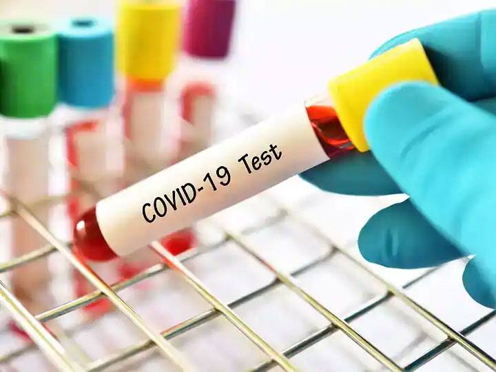 Negative report even if you have symptoms of corona virus know what you have to do rtpcr test कोरोना के लक्षण दिखने के बाद भी इसलिए आती है निगेटिव रिपोर्ट, जानें ऐसा होने पर क्या करें?