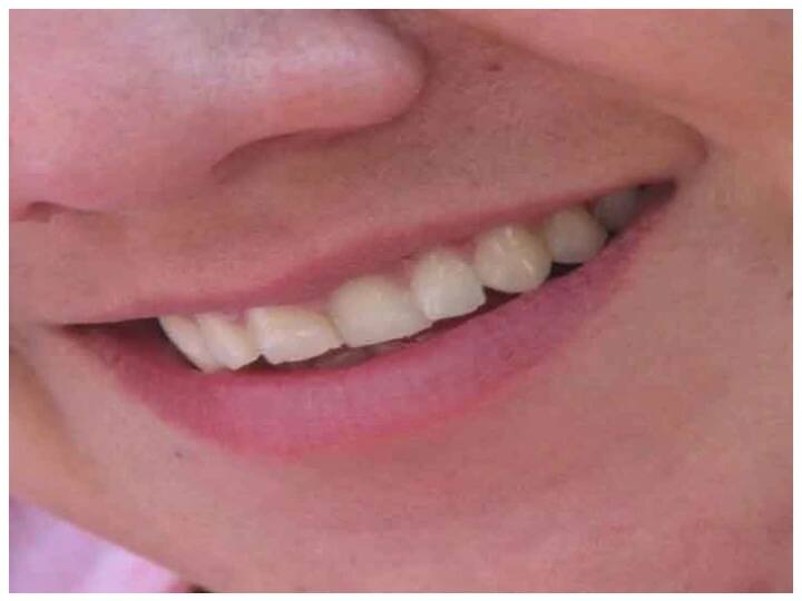 रिसर्च में दावा, पायरिया से पीड़ित कोरोना मरीजों में गंभीर रूप से बीमार होने और मौत का खतरा ज्यादा What is association between gum disease and severe covid-19 outcomes? Researchers tell this reason रिसर्च में दावा, पायरिया से पीड़ित कोरोना मरीजों में गंभीर रूप से बीमार होने और मौत का खतरा ज्यादा