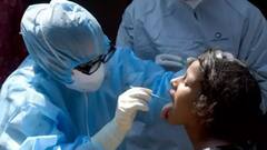 UP Covid Update: यूपी में कल के मुकाबले आज कम केस, लेकिन स्थिति अब भी चिंताजनक