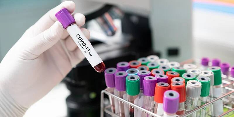 ICMR declare advisory about rt pcr test કેવા દર્દીઓના હવે RT PCR ન કરવાનો થઇ રહ્યો છે વિચાર, ICMRએ ટેસ્ટિંગ મામેલ શું જાહેર કરી એડવાઇઝરી