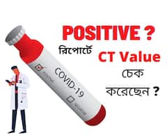 Covid19 Update : রিপোর্ট পজিটিভ ?  CT Value কম মানেই কি বিপদ ? জানুন বিস্তারিত