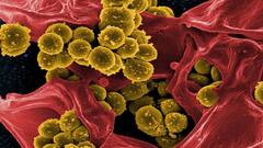 કોરોનાના રિકવર થયેલા દર્દીઓને થઇ રહી છે આ જીવલેણ બીમારી,જાણો શું છે તેના લક્ષણો