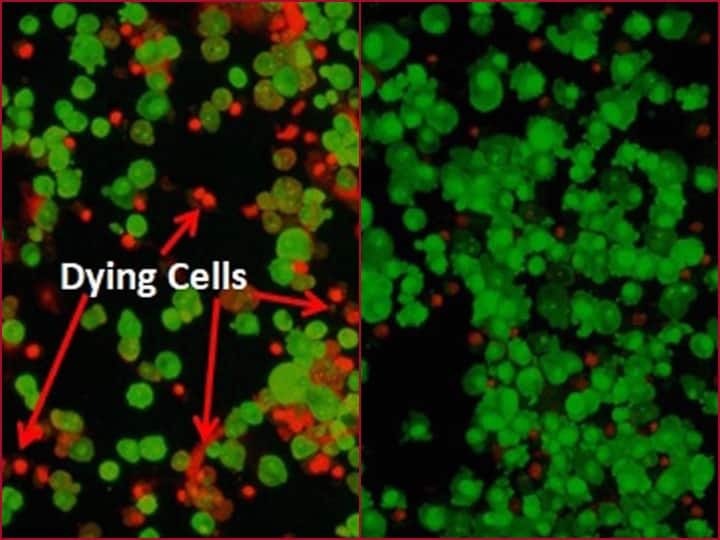 DRDO की एंटी-कोविड दवा के बारे में जानें सब कुछ, कैसे वायरस के खिलाफ करती है काम DRDO anti covid medicine know detail about it ANN DRDO की एंटी-कोविड दवा के बारे में जानें सब कुछ, कैसे वायरस के खिलाफ करती है काम