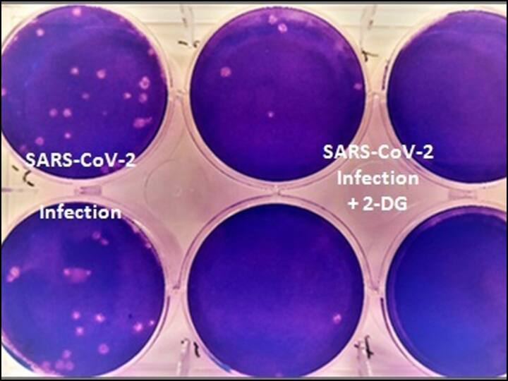 Coronavirus: Anti Covid Drug Developed by DRDO Cleared For Emergency Use कोरोना मरीजों के लिए 'संजीवनी बूटी' साबित होगी डीआरडीओ की ये दवा ?