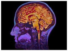 60 साल से पहले टाइप 2 डायबिटीज हो तो बुढ़ापे में डिमेंशिया का खतरा हो सकता है दोगुना- रिसर्च