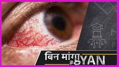 Corona से ठीक हुए लोगों में Black Fungus की शिकायत? आंख निकालने तक की नौबत आ जाती है! |