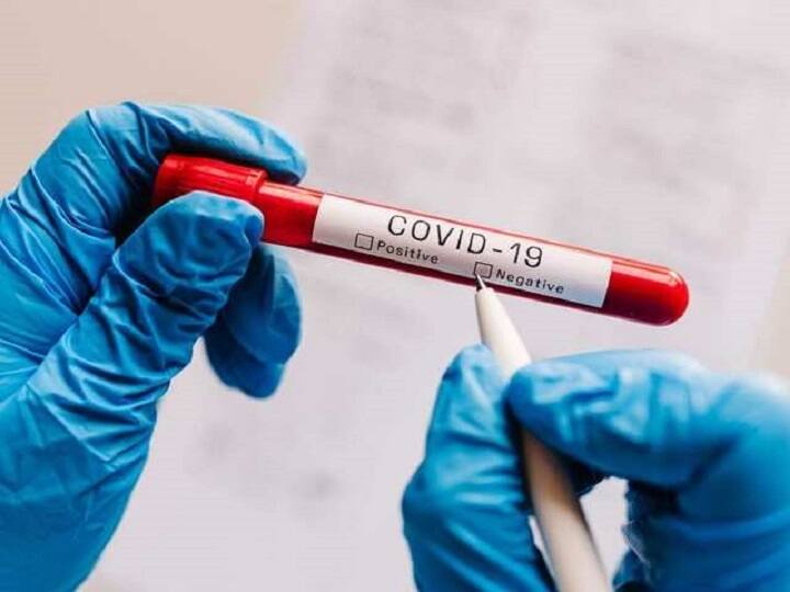 Covid-19: Corona can happen even if fever does not occur, know how to find out Covid-19: बुखार नहीं आने पर भी हो सकता है कोरोना, जानिए इन लक्षणों से पता करें