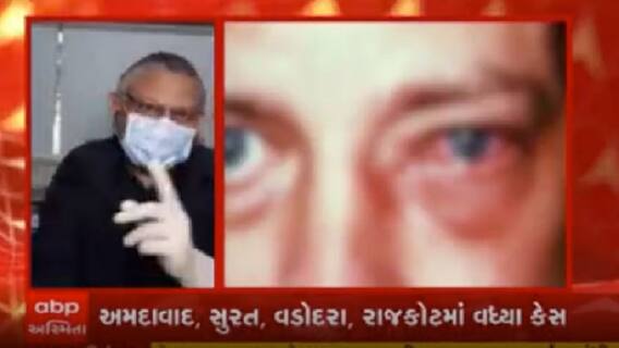 મ્યુકરમાયકોસિસની સારવાર મોંઘી છે ને લાખોમાં ખર્ચ થઈ જાય છે એવું કહેવાય છે.....મ્યુકરમાયકોસિસનાં આ નાનાં નાનાં લક્ષણો છે ને.....