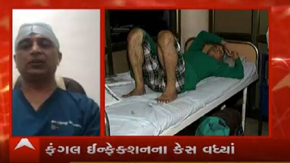 મ્યુકરમાઇકોસિસ રોગના શું છે લક્ષણો? આ રોગની સારવાર માટેના ઇન્જેક્શનની અછત