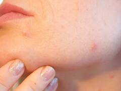 कोरफडने त्वचा आणि केस बनवा निरोगी; घरीच करा अ‍ॅलोवेरा जेल