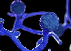 Lucknow में बढ़ा 'ब्लैक फंगस' का कहर, 24 मामले आए सामने और 2 की मौत