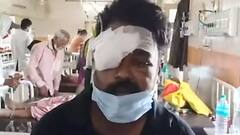 UP के बाद अब उत्तराखंड में भी सामने आए ब्लैक फंगस के मामले