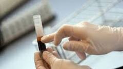 COVID Update: কোভিড চিকিৎসা প্রোটোকল থেকে বাদ পড়ল প্লাজমা থেরাপি