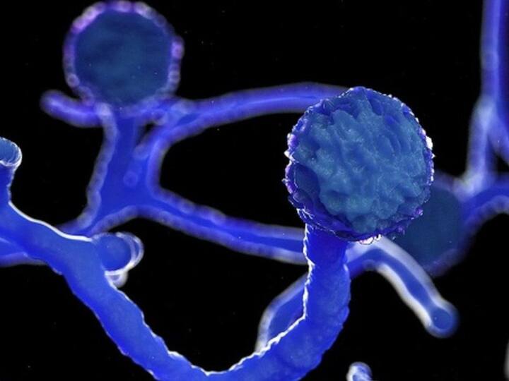 The woman of mp released the video and said I will die if I do not get injections for my husband महिला ने वीडियो जारी कर कहा- 'ब्लैक फंगस से पीड़ित पति के लिए इंजेक्शन नहीं मिले तो जान दे दूंगी'