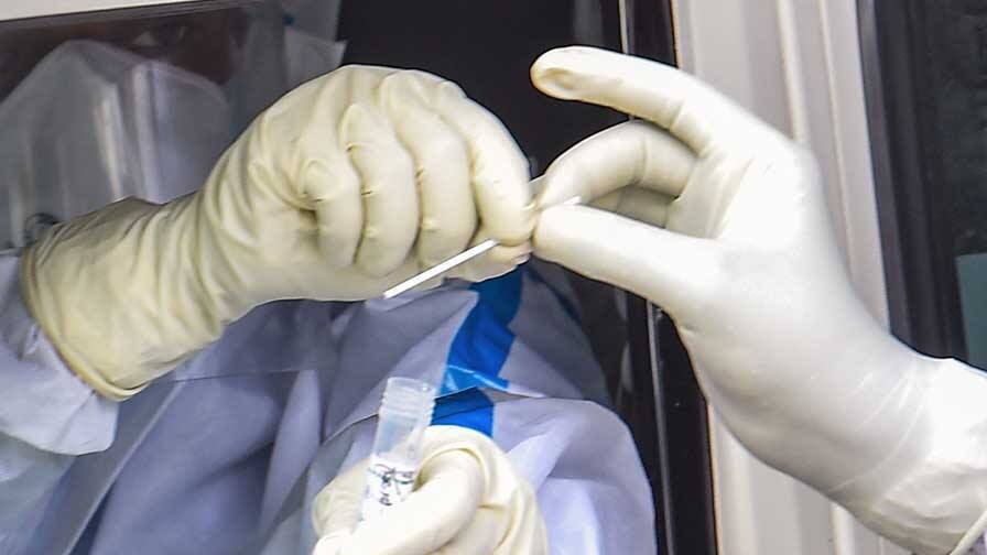 Pune Firm On CoviSelf Home Test Kit guidelines, get to know in details CoviSelf Home Kit : ২ মিনিটে টেস্ট, ১৫ মিনিটে রেজাল্ট দেবে কোভিসেল্ফ