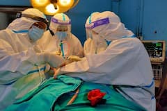 UP में बढ़ा 'Black Fungus' का खतरा, Lucknow और Varanasi में आए कई मामले