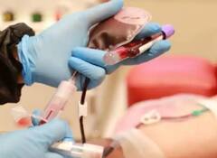 Coronavirus: प्लाज्मा थेरेपी पर बढ़ा कन्फ्यूजन, IMA ने कहा- मरीज के तीमारदार की मंजूरी से दिया जा सकता है