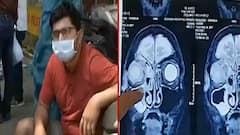 Uttarakhand: पहाड़ों पर Corona Control, कम होने लगे केस, लेकिन बढ़ा Black Fungus का खतरा