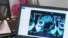 Black Fungus deadly for diabetes patients | ICH