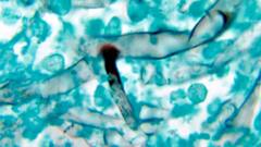 Black Fungus Epidemic: মহামারী আইনের অধীনে ব্ল্যাক ফাঙ্গাস সংক্রমণের তথ্য রাজ্যগুলিকে দেওয়ার নির্দেশ কেন্দ্রের