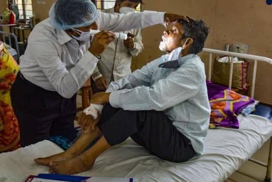 Rajasthan govt declared black fungus mycormycosis as an epidemic ગુજરાતને અડીને આવેલા આ રાજ્યએ મ્યુકોરમાઈકોસિસને મહામારી જાહેર કરી, રાજ્યમાં પણ વધી રહ્યો છે કહેર