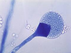 Delhi on Black Fungus : দিল্লির তিনটি হাসপাতালে ব্ল্যাক ফাঙ্গাসের চিকিৎসার ব্যবস্থা করবে কেজরিওয়াল সরকার