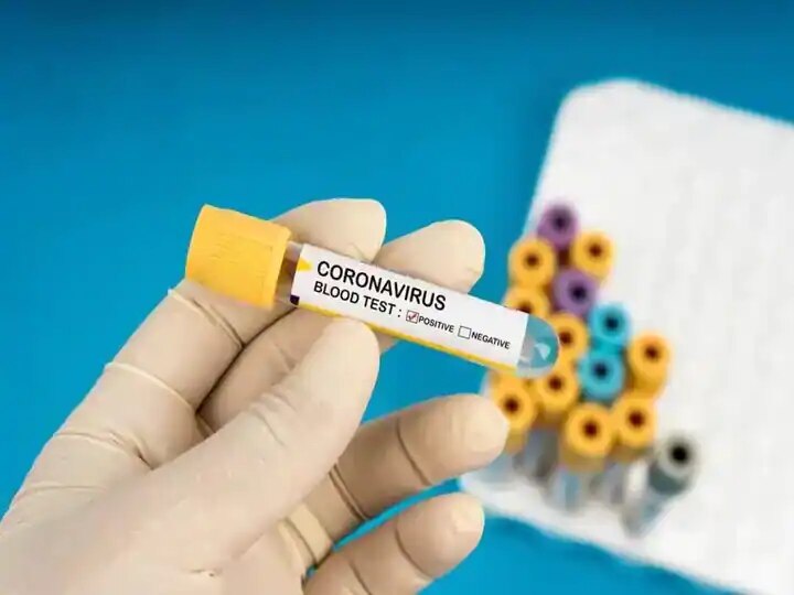 Coronavirus Cases in India: மீண்டும் 4 ஆயிரத்தை கடந்த கொரோனா உயிரிழப்பு 