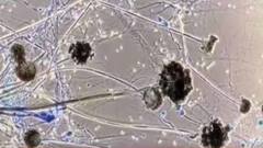 Black Fungus Infection: 'কোভিড একমাত্র কারণ নয়', ব্ল্যাক ফাঙ্গাস সংক্রমণ প্রসঙ্গে জানাল রাজ্য স্বাস্থ্য দফতর
