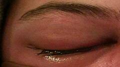 মিউকরমাইকোসিসে আক্রান্তের সংখ্যা ১২ হাজার ছুঁইছুঁই, ওষুধ বরাদ্দ কেন্দ্রের