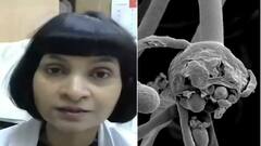 'Black Fungus संक्रामक नहीं है, छूने से नहीं फैलता'- Dr Padma Srivastava; जानिए अपने हर शंका का जवाब
